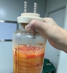忻州水动力吸脂手术要做多久？